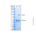 Recombinant Human TPST1 Protein