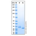 Recombinant Human VSIG8 Protein