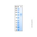 Recombinant Human IL-27 Ra/WSX-1/TCCR Protein