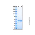 Recombinant Mouse RSPO1 Protein