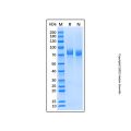 Recombinant Human IL-6/IL-6R alpha Protein