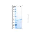 Recombinant Human Creatine Kinase MM/CKMM Protein