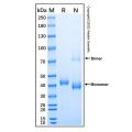 Recombinant Human Cathepsin H Protein