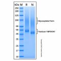 Recombinant Human Testican 1/SPOCK1 Protein