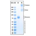 Recombinant Human IL-17RB Protein