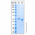 Recombinant Human GCNT1 Protein