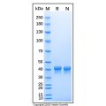 Recombinant Mouse Chitinase 3-like 1/YKL-40 Protein