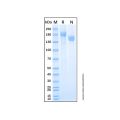 Recombinant Human IGF-II R/IGF2R Protein