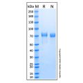 Recombinant Human SMPD1 Protein