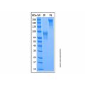 Recombinant Mouse IL-15R alpha Protein