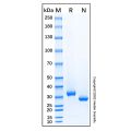 Recombinant Human sFRP-2 Protein