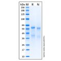 Recombinant Human ADAM8 Protein