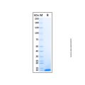 Recombinant Human Complement Component C5a Protein