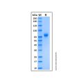 Recombinant Human CD19 protein