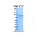 Recombinant Human HDAC1 Protein
