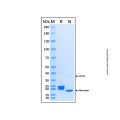 Recombinant Human IL-17C Protein