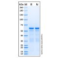 Recombinant Human AKT1 Protein