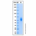 Recombinant Human CD21 Protein