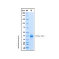Recombinant Human TGF-beta RI/ALK-5 Protein