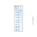 Recombinant Human Pappalysin-2/PAPP-A2 Protein