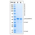 Recombinant Human p38 alpha Protein