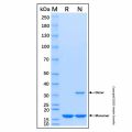 Recombinant Human PDK1 Protein