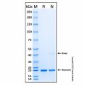 Recombinant Human PLK1 Protein