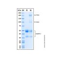 Recombinant Human Angiopoietin-like 7 Protein