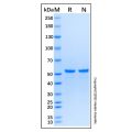Recombinant Human IRS1 Protein