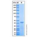 Recombinant Human Sirtuin 3/SIRT3 Protein
