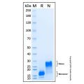 Recombinant Mouse AgRP Protein