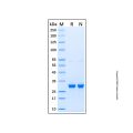 Recombinant Human DCK Protein