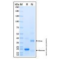Recombinant Human GILT Protein