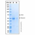 Recombinant Human Factor I/CFI Protein