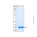 Recombinant Human CRYGC Protein