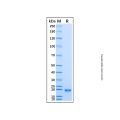 Recombinant Human CTDSPL Protein