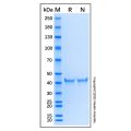 Recombinant Human 53BP1 Protein