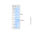 Recombinant Human Cdk9 Protein