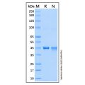 Recombinant Human ETNK2 Protein