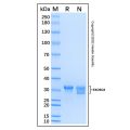 Recombinant Human EXOSC8 Protein