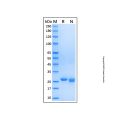 Recombinant Human FAHD1/Oxaloacetate decarboxylase Protein
