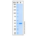 Recombinant Human RAD51B Protein