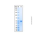 Recombinant Human UQCRC1 Protein