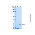 Recombinant Human BTK Protein