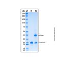 Recombinant Human HDAC2 Protein
