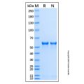 Recombinant Human Tyrosine Hydroxylase Protein 
