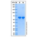 Recombinant Human Alkaline Phosphatase Protein