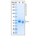 Recombinant Mouse IL-12 p40/IL-12B Protein