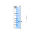 Recombinant Human IKK beta Protein