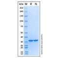 Recombinant Human Thymidylate Synthase Protein